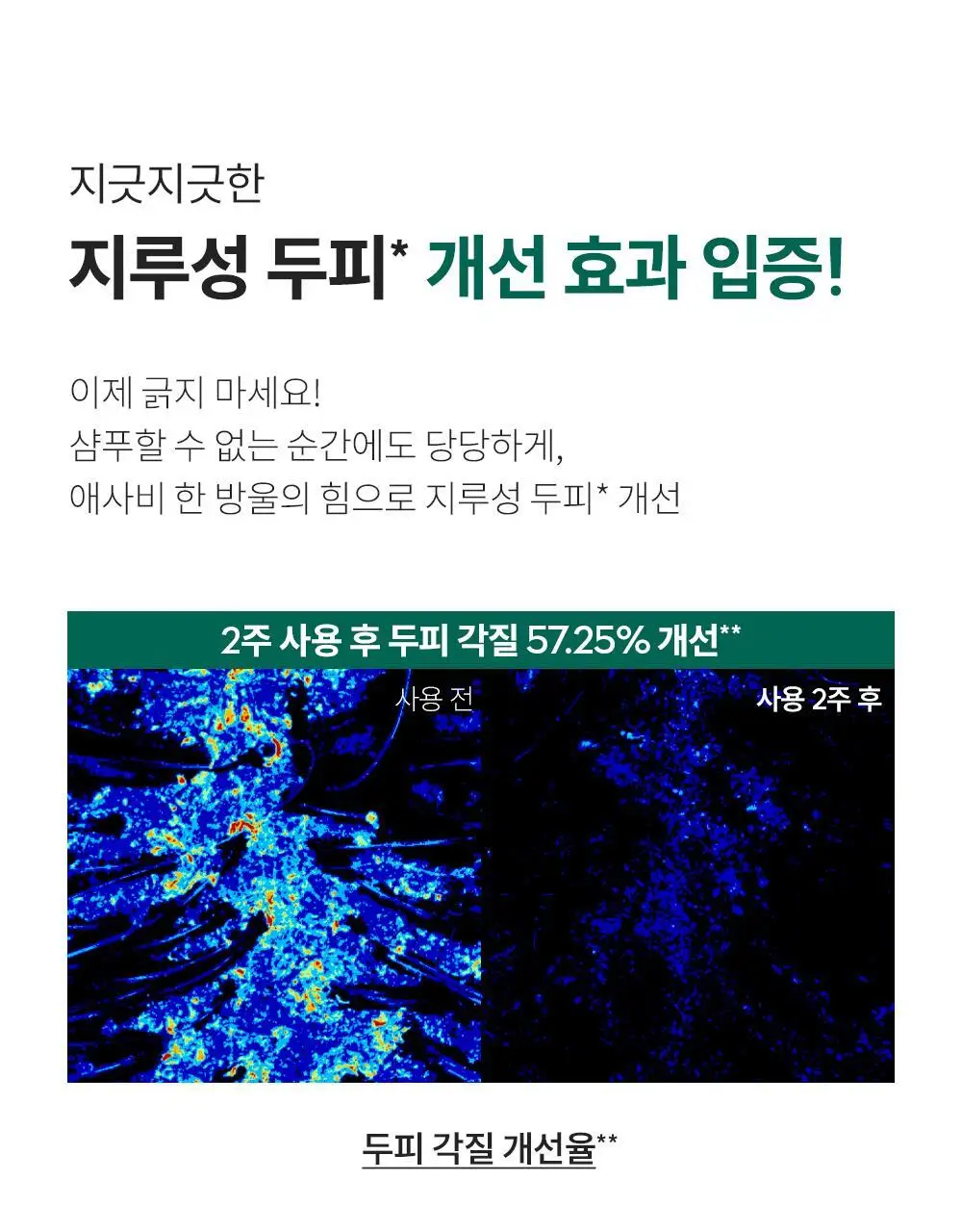 [지루성 두피케어] 낫포유 지성두피 트러블케어 미스트 80ml 기획 (+미니어처 30ml) 상세페이지 29